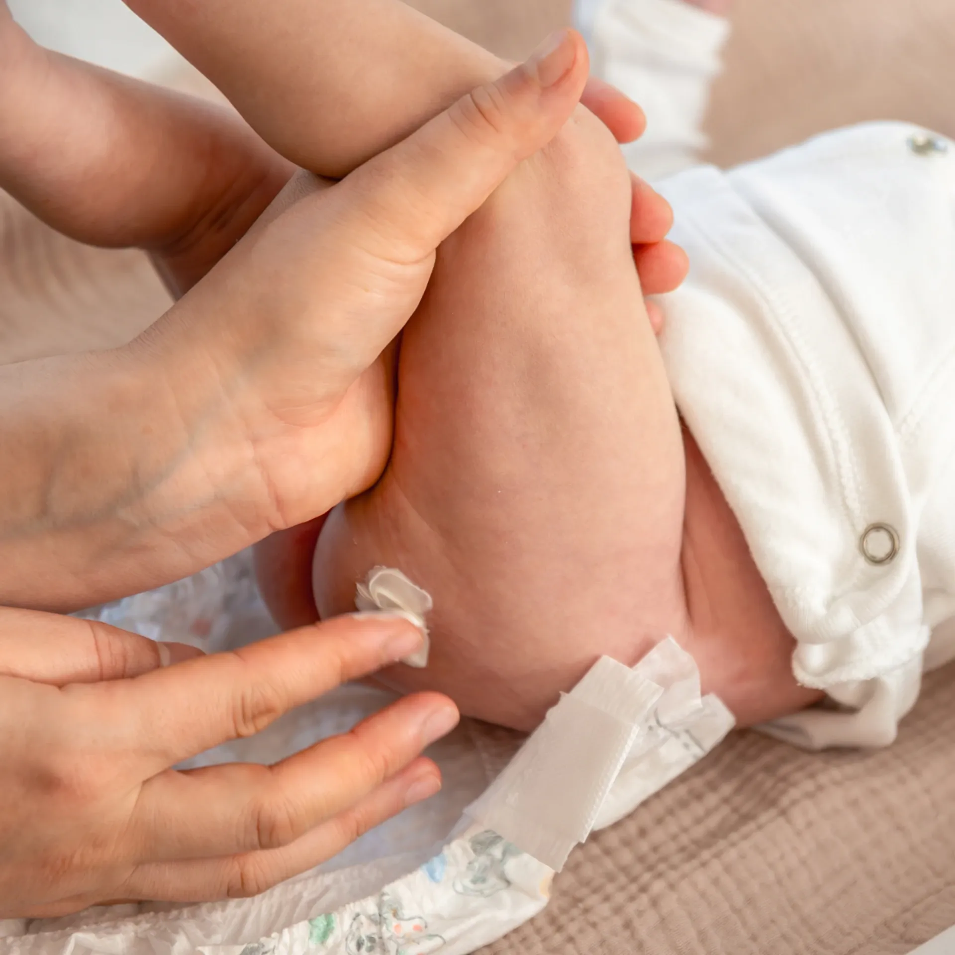 Crema all'ossido di zinco